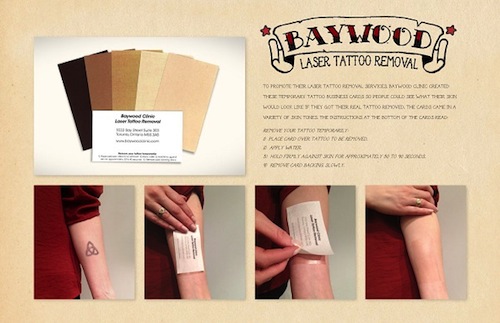 Tattoo Removal Business Card